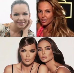 Как изглеждаха Галена и Николета преди корекциите, снимки които ...